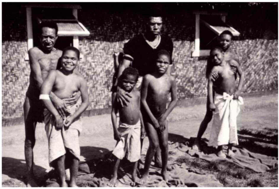 Cannibalism led to the spread of Kuru among the Fore people. The disease causes progressive loss of motor control, tremors, and neurological degeneration, leading inevitably to death. In the image, parents hold children affected by Kuru at a clinic.